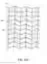 Fig. 85 - Negative pressure wound closure device