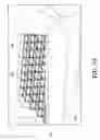 Fig. 87 - Negative pressure wound closure device