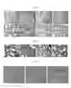 Fig. 02 - Methods for treating pulmonary fibrosis