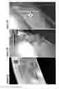 Fig. 04 - MICRO-SLITS FOR RETICULOCYTE MATURATION