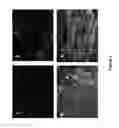 Fig. 04 - DNA ANTIBODY CONSTRUCTS FOR USE AGAINST EBOLA VIRUS