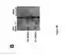 Fig. 06 - DNA ANTIBODY CONSTRUCTS FOR USE AGAINST EBOLA VIRUS