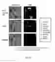 Fig. 20 - Alkylating agent for alkylating target with driver oncogene mutation