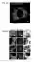 Fig. 06 - Compositions and methods for mitochondrial genome editing