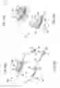 Fig. 24 - Device and method for sterilizing a catheter system