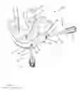 Fig. 09 - Knee spacer system with irrigation device