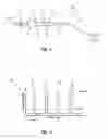 Fig. 02 - Systems and methods for correcting and preventing occlusion in a catheter