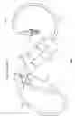Fig. 02 - Linearly actuated flow controller for intravenous (IV) fluid administration