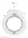 Fig. 06 - CATHETER AND METHOD FOR MANUFACTURING CATHETER