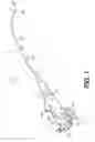 Fig. 02 - Steerable catheter with brake assembly