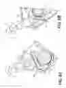 Fig. 07 - Steerable catheter with brake assembly