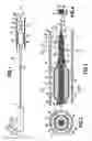 Fig. 02 - Device forming an infusion catheter for treating at least one partial or total obstruction in a passage, such as a body passage