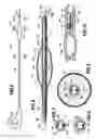 Fig. 03 - Device forming an infusion catheter for treating at least one partial or total obstruction in a passage, such as a body passage