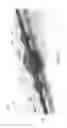 Fig. 09 - TWO-STAGE LOCKING CATHETER SPLICE ASSEMBLY