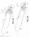 Fig. 03 - Implantable medical electrode assemblies and associated devices and methods
