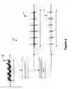 Fig. 06 - System and methods for heart rate and electrocardiogram extraction from a spinal cord stimulation system