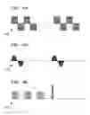 Fig. 07 - Secretion clearance and cough assist