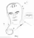 Fig. 02 - NON-CONTINUOUS ELECTRICAL STIMULATION THERAPY