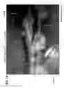 Fig. 02 - Treatment of inflammatory disorders