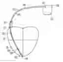 Fig. 01 - Supraventricular tachy sensing vector
