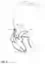 Fig. 02 - Implantable medical devices, and methods of use therewith, that detect MRI systems with enhanced specificity