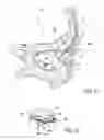 Fig. 07 - Systems and methods for treatment of dry eye
