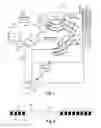 Fig. 02 - IMPLANTABLE PROSTHESES FOR REDUCING VISIBILITY OF BULGING FROM IMPLANTED MEDICAL DEVICES