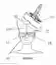 Fig. 01 - APPARATUS AND METHOD FOR DETERMINING A DESIRED COIL POSITION FOR MAGNETIC STIMULATION