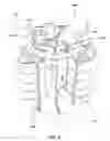 Fig. 04 - Incentive spirometer for sustained maximal inspiration