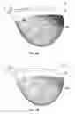 Fig. 07 - Golf club head with hosel support structure