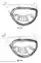 Fig. 12 - Golf club head with hosel support structure