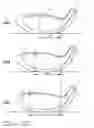 Fig. 01 - Golf club set