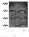 Fig. 02 - BACTERIA MICROTRAPS