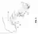 Fig. 03 - Hook tensioner