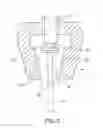 Fig. 03 - GRIPPING TEETH AND GRIPPER