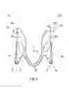 Fig. 04 - Elastic fastener for razor
