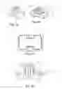 Fig. 05 - Device for reinforcing, sealing or insulating a structural element