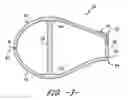 Fig. 04 - Methods for manufacturing flatback airfoils for wind turbine rotor blades
