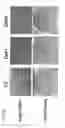 Fig. 02 - NOTCH ACTIVATION ENHANCES MESENCHYMAL STEM CELL SHEET OSTEOGENIC POTENTIAL BY INHIBITION OF CELLULAR SENESCENCE