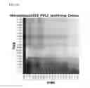 Fig. 49 - Compositions and methods comprising digital signatures to predict response and resistance to targeted therapy and immunotherapy