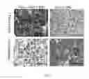 Fig. 16 - THERAPEUTIC TREATMENT OF SELECT DIFFUSE LARGE B CELL LYMPHOMAS EXHIBITING DISTINCT PATHOGENIC MECHANISMS AND OUTCOMES