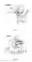 Fig. 55 - THERAPEUTIC TREATMENT OF SELECT DIFFUSE LARGE B CELL LYMPHOMAS EXHIBITING DISTINCT PATHOGENIC MECHANISMS AND OUTCOMES