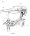 Fig. 02 - Dispenser for binary viscous fluids with aggregate