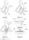 Fig. 09 - Unidirectionally extendable cutting element steering