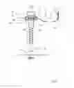 Fig. 03 - Screw-retaining device and screw-retaining kit