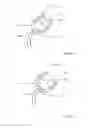 Fig. 05 - Screw-retaining device and screw-retaining kit