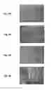 Fig. 05 - SLIDABLE STRUCTURE AND A METHOD FOR PRODUCING THE SAME