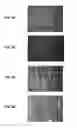 Fig. 06 - SLIDABLE STRUCTURE AND A METHOD FOR PRODUCING THE SAME
