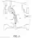 Fig. 03 - Cushioned Check Valve