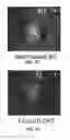 Fig. 11 - LIGHTWEIGHT THERMAL TRANSPORT DEVICES AND METHODS